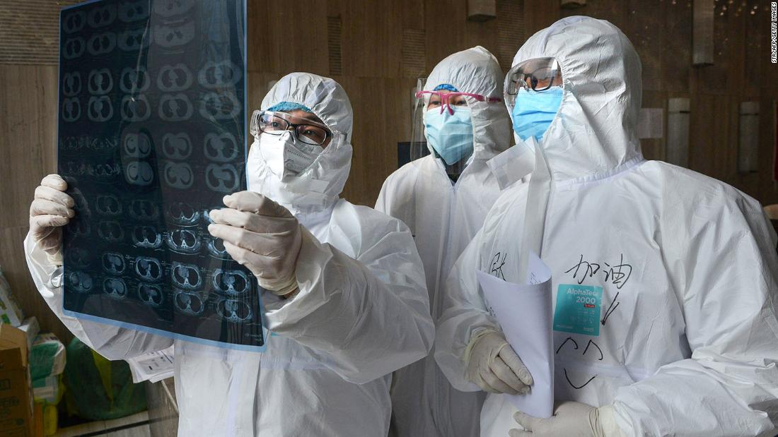 Doctors look at a CT scan of a lung at a hospital in Xiaogan, China, on February 20, 2020.