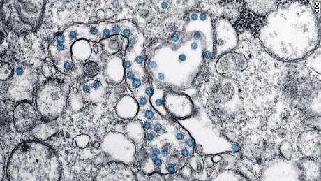 Live updates: Coronavirus deaths pass 6,000 