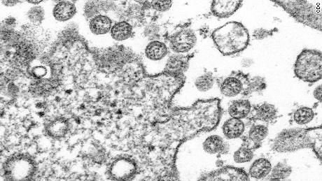 Coronavirus pandemic upends daily life