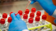 Confusion over the availability and criteria for coronavirus testing is leaving sick people wondering if they&#39;re infected