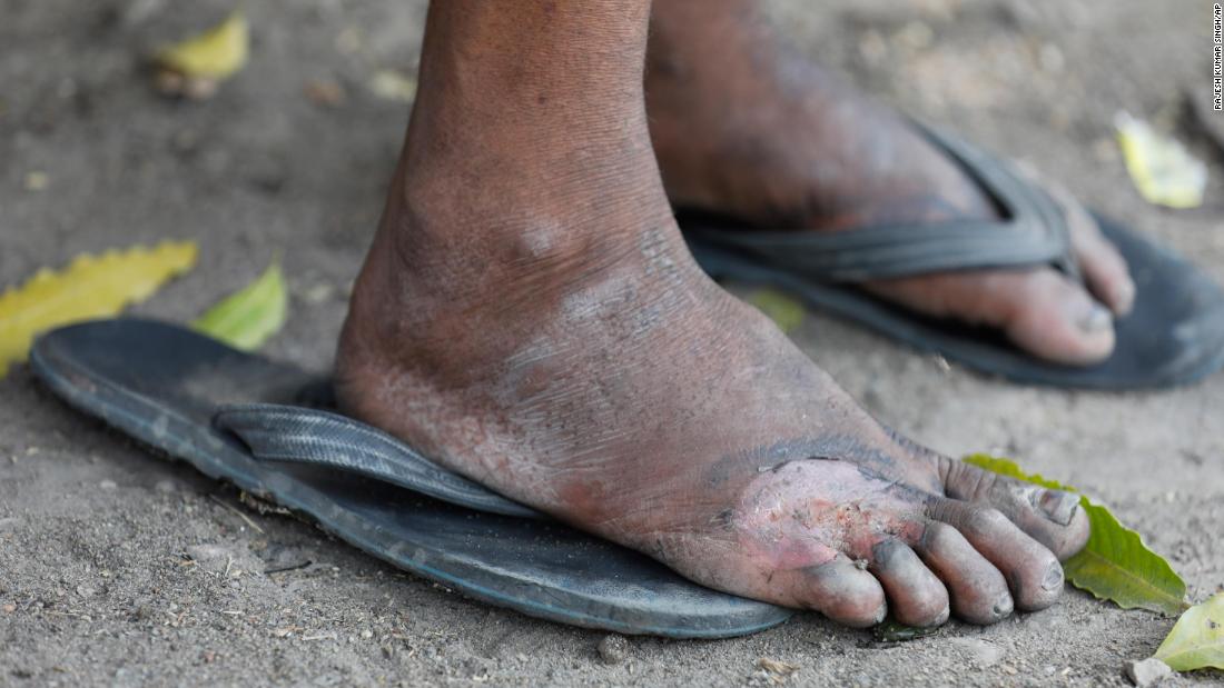 A laborer rests on the outskirts of Prayagraj en route to his village. With India's rail network temporarily shut, many had no choice but to try walking hundreds of miles home.