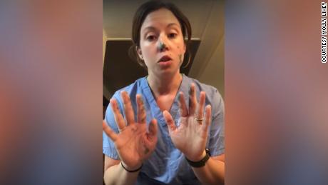 This nurse demonstrates just how fast germs spread even if you're wearing gloves