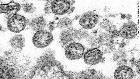 This 2020 electron microscope made available by the U.S. Centers for Disease Control and Prevention image shows the spherical coronavirus particles from the first U.S. case of COVID-19. On Monday, May 4, 2020, New York City health authorities issued an alert to doctors about severe inflammatory condition possibly linked with COVID-19 has been found in a cluster of U.S. children in New York City after first being reported in Europe. On Wednesday, New York said 64 potential cases had been reported to the state. Fever, abdominal pain and skin rashes are common symptoms of the unnamed condition, which has features similar to Kawasaki disease and toxic shock syndrome. (C.S. Goldsmith, A. Tamin/CDC via AP)