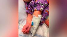 Kids with suspected Covid-related syndrome need immediate attention, doctors say