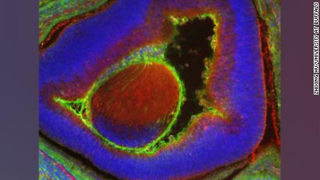 Researchers at the State University of New York at Buffalo injected human stem cells into a mouse embryo using a special technology.