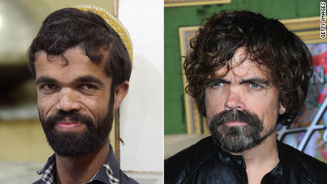 Pakistani waiter Rozi Khan (left) and actor Peter Dinklage.