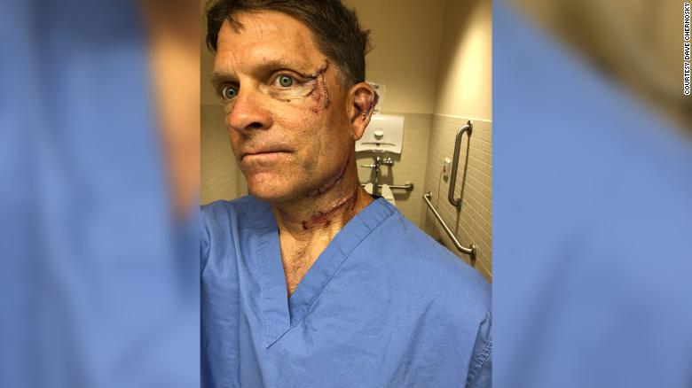 Dave Chernosky is recovering from cuts to his face and back after an encounter with a bear that got into the kitchen of the house where he's staying.