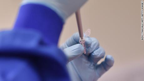 The first Phase 3 coronavirus vaccine trial in the US is expected to begin next week