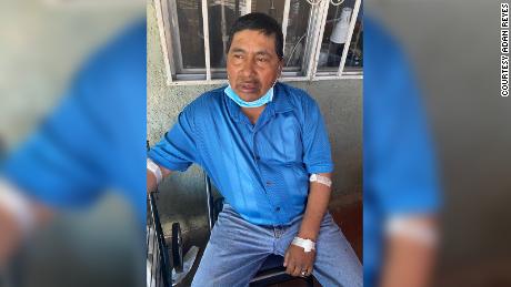Miguel Medina, a street vendor in Los Angeles was released from the hospital on Thursday after he was knocked unconscious during a robbery.