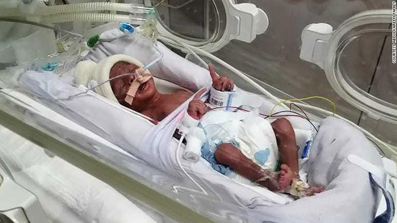 The quadruplet babies were born July 1 at the Latifah Women and Children&#39;s Hospital in Dubai.