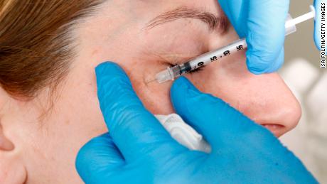 Botox could ease depression in addition to wrinkles, study finds