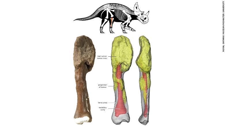 The dinosaur&#39;s main tumor mass is at the top of the bone, and can be seen on the 3D reconstruction in yellow. Centrosaurus diagram by Danielle Dufault. Courtesy of Royal Ontario Museum.