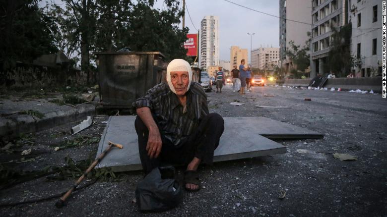 A man sits near the site of the blast.