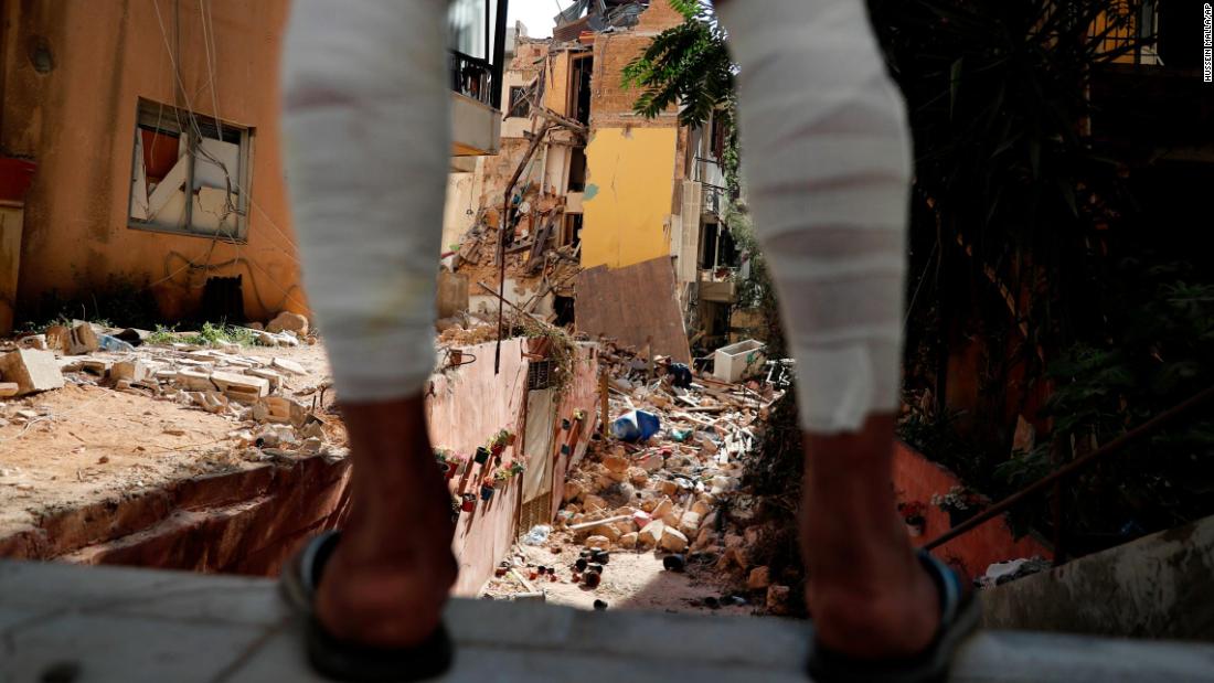 A man whose legs were injured because of the explosion looks at a destroyed house on August 7, 2020.