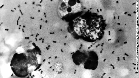 UNDATED PHOTO:  A bubonic plague smear, prepared from a lymph removed from an adenopathic lymph node, or bubo, of a plague patient, demonstrates the presence of the Yersinia pestis bacteria that causes the plague in this undated photo. The FBI has confirmed that about 30 vials that may contain bacteria that could cause bubonic or pneumonic plague have gone missing, then found, from the Health Sciences Center at Texas Tech University January 15, 2003 in Lubbock, Texas. The plague, considered a likely bioterror agent since it&#39;s easy to make, is easily treatable with antibiotics if diagnosed early and properly.  (Photo by Centers for Disease Control and Prevention/Getty Images)