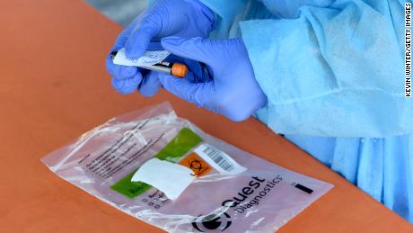 Plenty of coronavirus tests are available, but they're not being used