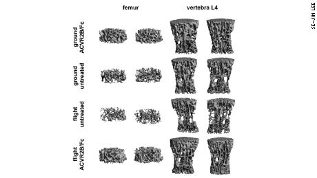 This chart compares microCT images of femurs and vertebrae of treated and untreated mice exposed to a lack of gravity in space.