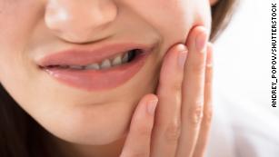 Dentists are seeing more cracked teeth. Pandemic stress is to blame