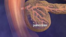 Why pancreatic cancer is so deadly