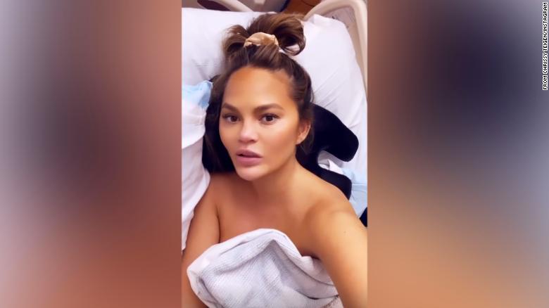 Chrissy Teigen hospitalized after suffering bleeding during latest pregnancy