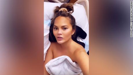 Chrissy Teigen hospitalized after suffering bleeding during latest pregnancy  
