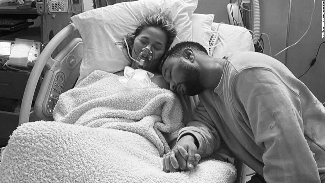 Chrissy Teigen Loses Baby After Pregnancy Complications Calling It The Darkest Of Days Cnn