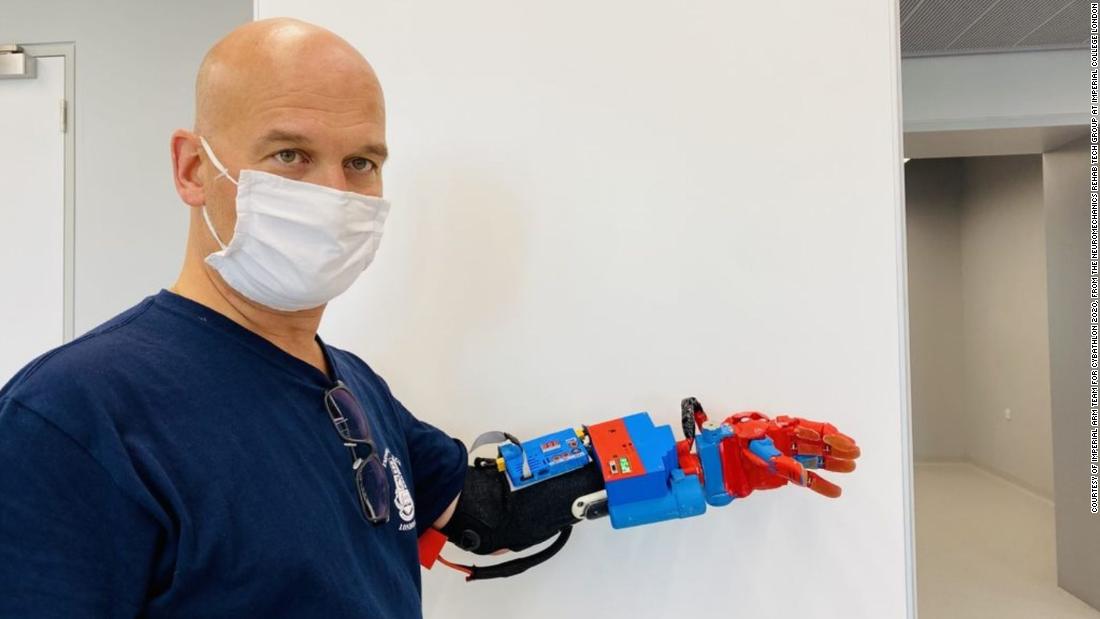 This bionic arm prosthetic developed by students at Imperial College London can feel how rough objects are.