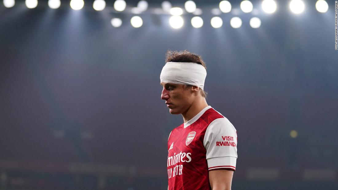 Head injuries in professional sports...a collision during the Ars/Wol match left one player with fractured skull and another playing through injury