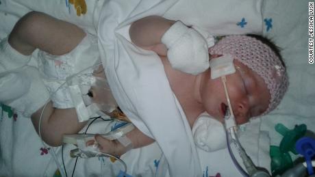 Brandi, who is here in the intensive care unit as a baby, has already beaten expectations.