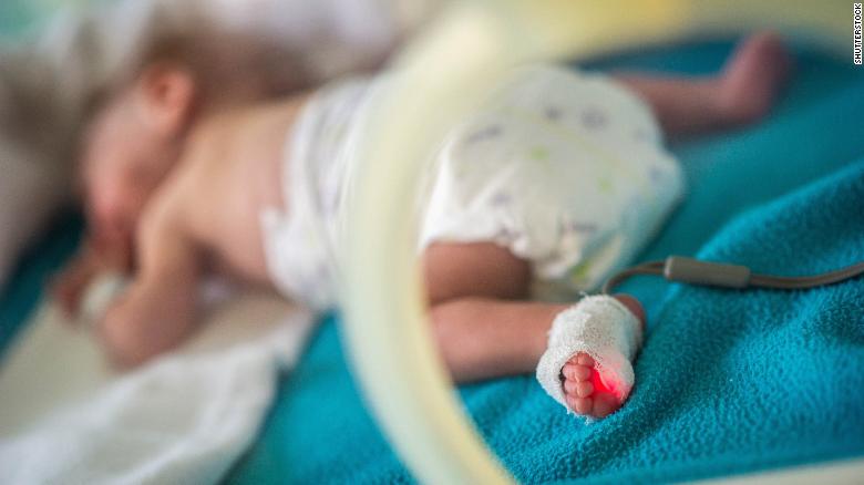 Preemies may have greater risk of premature death as adults, study suggests
