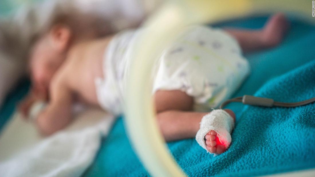 preemies-may-have-greater-risk-of-premature-death-as-adults-study-suggests