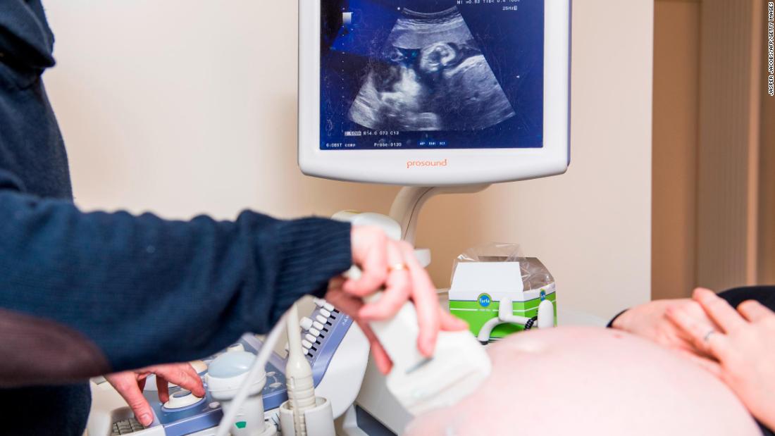 Babies get Covid-19 antibodies from mothers while in the womb, study finds
