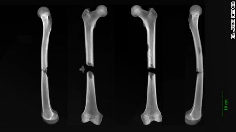 X-rays show butterfly fractures to both femurs of a man buried in the Augustinian friary.