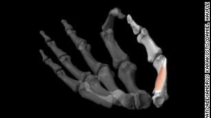 Thumbs gave human ancestors a &#39;formidable&#39; advantage