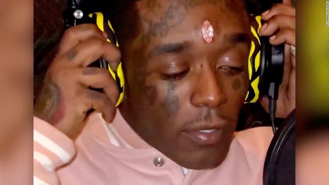 Lil Uzi Vert says fans ripped $24 million diamond out of his forehead