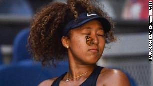 TOPSHOT - A butterfly lands on Japan&#39;s Naomi Osaka as she plays against Tunisia&#39;s Ons Jabeur during their women&#39;s singles match on day five of the Australian Open tennis tournament in Melbourne on February 12, 2021. (Photo by Paul CROCK / AFP) / -- IMAGE RESTRICTED TO EDITORIAL USE - STRICTLY NO COMMERCIAL USE -- (Photo by PAUL CROCK/AFP via Getty Images)