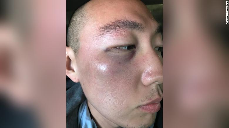Attack on Asian American man in LA’s Koreatown being investigated as a hate crime