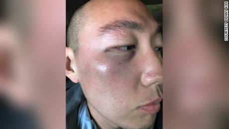 Attack on Asian American man in LA&#39;s Koreatown being investigated as a hate crime