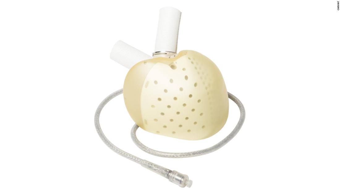 This new artificial heart responds to the patient