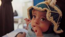 Ten-month-old Zahra sits in her mother's arms at the Rural Harf Soufian Hospital, where she has become a celebrated success story.