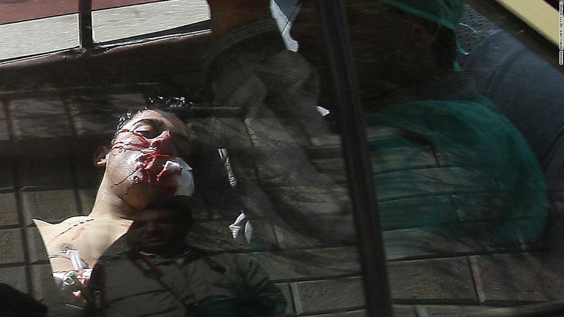 An injured man lying in the back of a vehicle is rushed to a hospital in Daraa, Syria, on March 23, 2011. Violence flared in Daraa after a group of teens and children were arrested for writing political graffiti. Dozens of people were killed when security forces cracked down on demonstrations.
