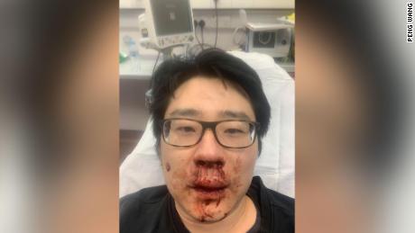 Peng Wang, professeur d'université, a été agressé alors qu'il faisait du jogging fin février à Southampton, dans le sud de l'Angleterre.