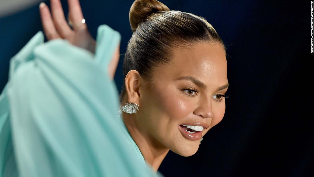 Chrissy Teigen says she had surgery to remove the fat from her cheeks