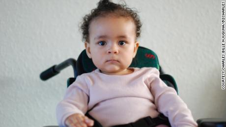 Ayah is 14 months old and suffers from spinal muscular atrophy, which affects one in 10,000 children.