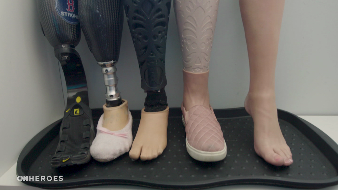 N.S. woman needs a waterproof prosthetic leg — and she's getting lots of  support