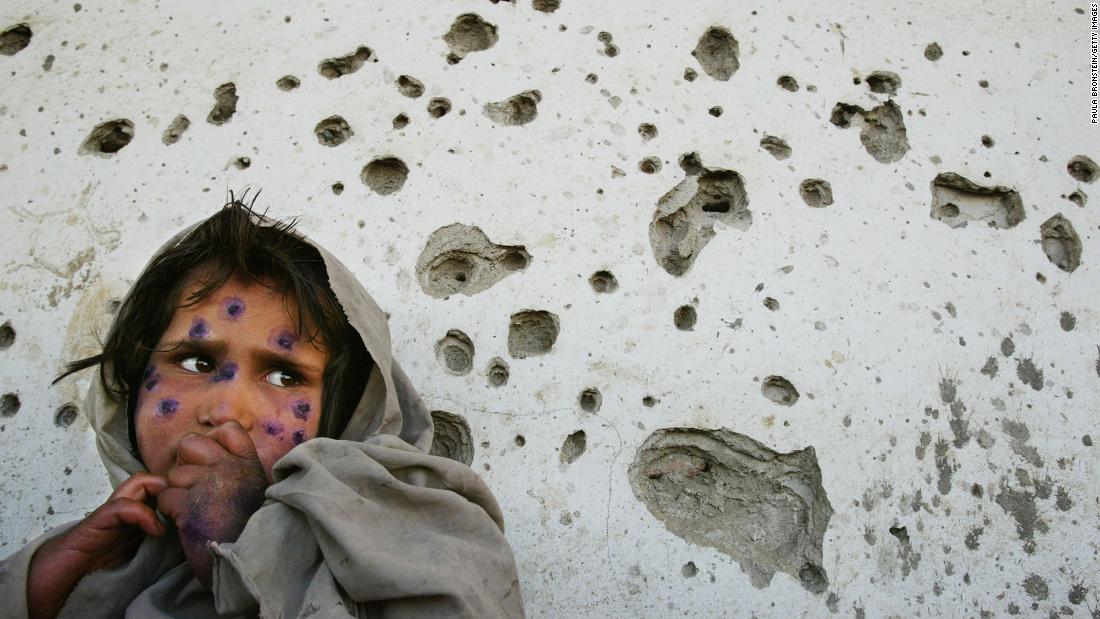 Mohboba, 7, stands near a bullet-ridden wall in Kabul as she waits to be seen at a health clinic in March 2002. She had a skin ailment that plagued many &lt;a href=&quot;https://www.cnn.com/2016/05/31/middleeast/cnnphotos-afghanistan-between-hope-and-fear&quot; target=&quot;_blank&quot;&gt;poverty-stricken children in Afghanistan.&lt;/a&gt;