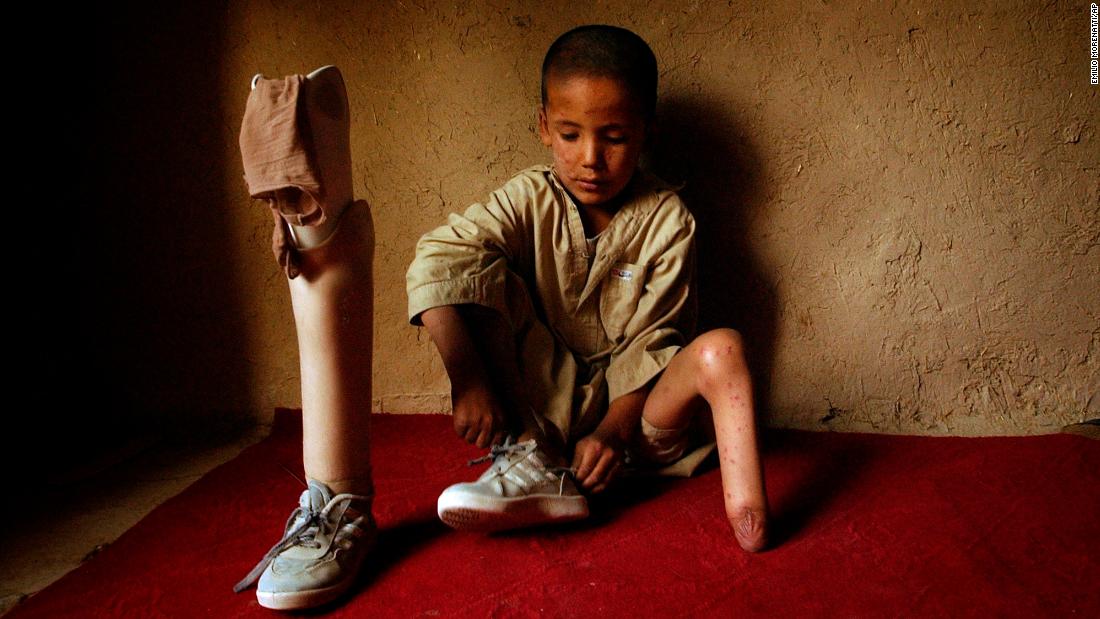 Mohammaed Mahdi, who lost his foot in a mine explosion, waits for a Red Cross doctor at his home in Kabul in August 2004. This photo was taken by Associated Press photographer Emilio Morenatti, who five years later lost part of his leg when the armored vehicle he was in hit a roadside bomb.