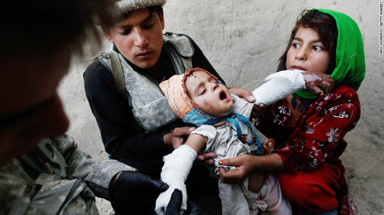 Halawasha, right, and an Afghan National Police member hold her young sister Shokria as a US Army medic wraps her serious burns in Now Ruzi, Afghanistan, in October 2010. US soldiers were on a routine patrol when they came across Shokria, whose forearms were burned with scalding milk during a household accident five days earlier. Medics dressed the burns and began working with local Afghan military to have the girl driven to a nearby hospital.