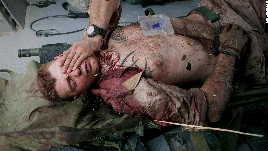 US Marine Cpl. Burness Britt reacts after being lifted onto a medevac helicopter in June 2011. A large piece of shrapnel from an improvised explosive device cut a major artery on his neck near Sangin, Afghanistan. This photo was taken by Anja Niedringhaus, an Associated Press photographer &lt;a href=&quot;https://www.cnn.com/2014/04/04/world/asia/afghanistan-journalists-shot/index.html&quot; target=&quot;_blank&quot;&gt;who was fatally shot in Afghanistan in 2014.&lt;/a&gt;