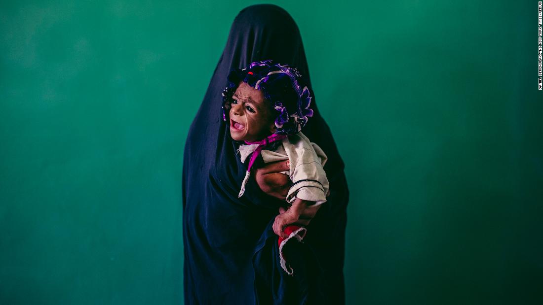 Samiullah, 8 months old and malnourished, is held by his mother, Islam Bibi, at a Doctors Without Borders hospital in Lashgar Gar, Afghanistan, in September 2013.